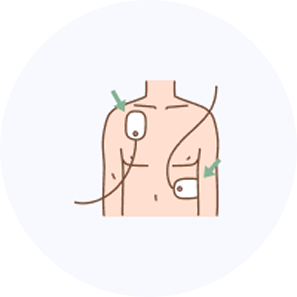 두 개의 패드 부착